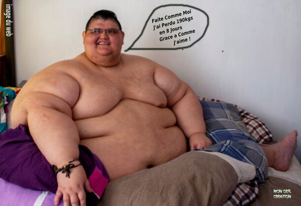BO21. Humour - Fattest Man 520 kgs & Comme J'Aime